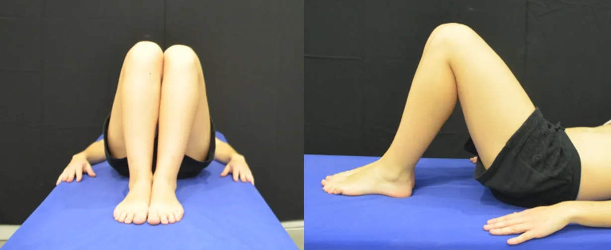 Test de Allis Galeazzi