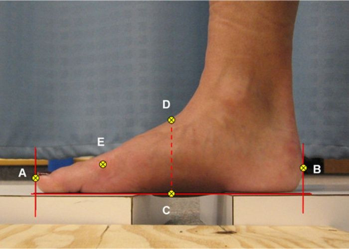 Avaluació clínica del peu