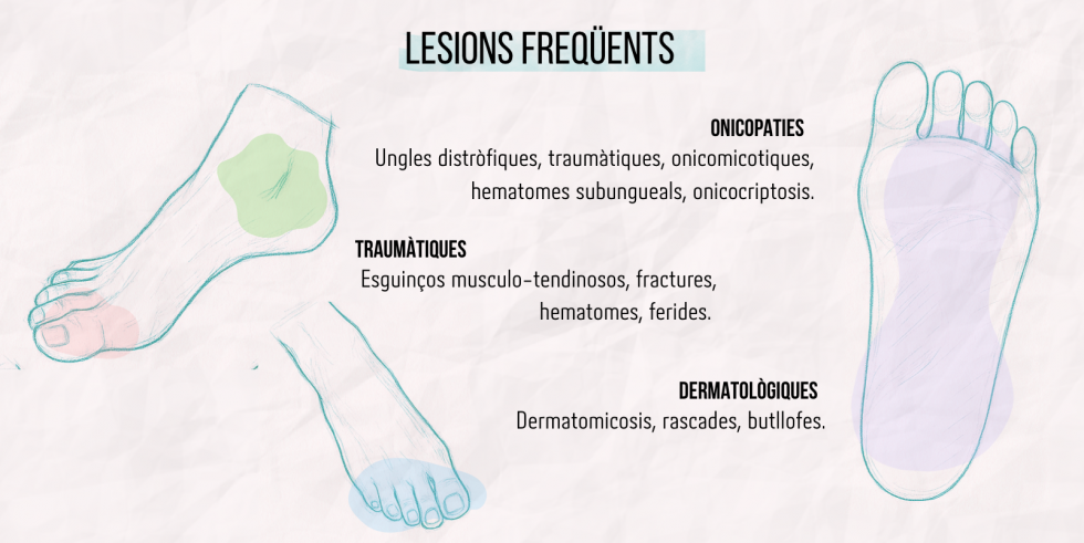 Lesions freqüents a les Spartan Race