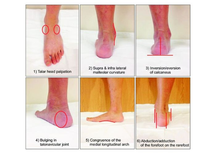 Avaluació clínica del peu